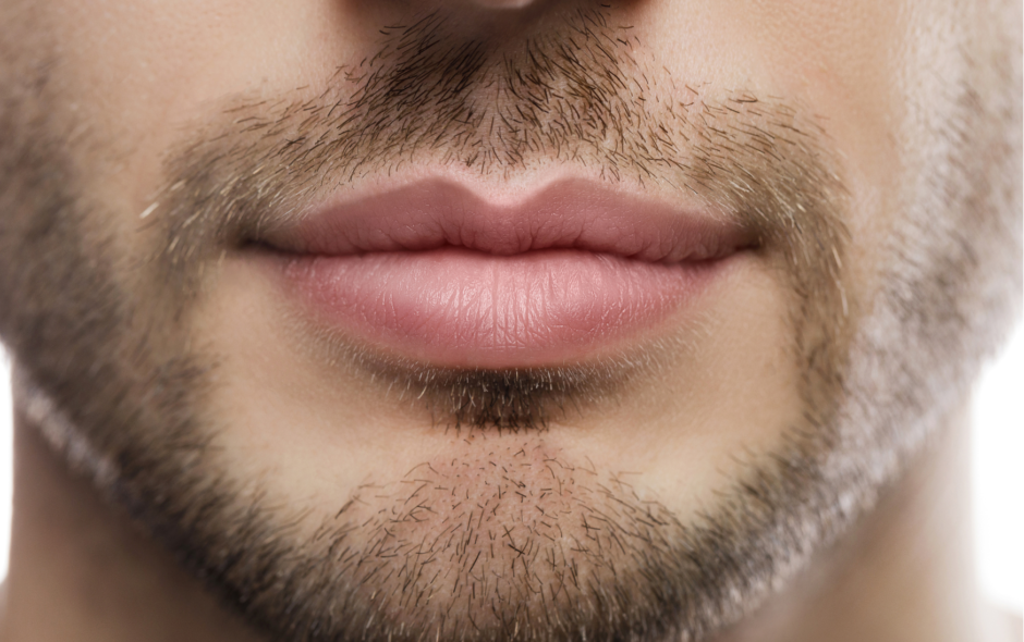 Are Lip Fillers Suitable for Men? 