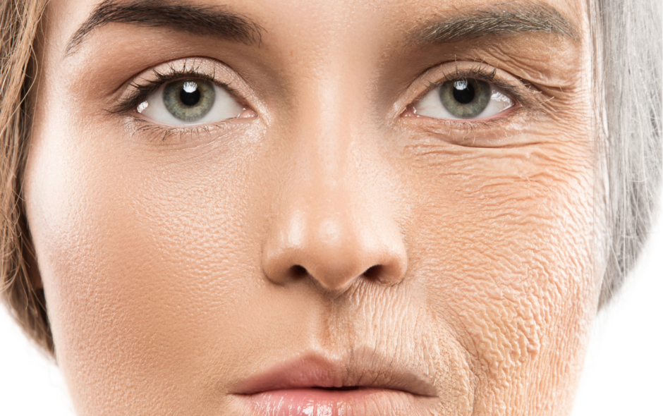 What is a non surgical face lift?