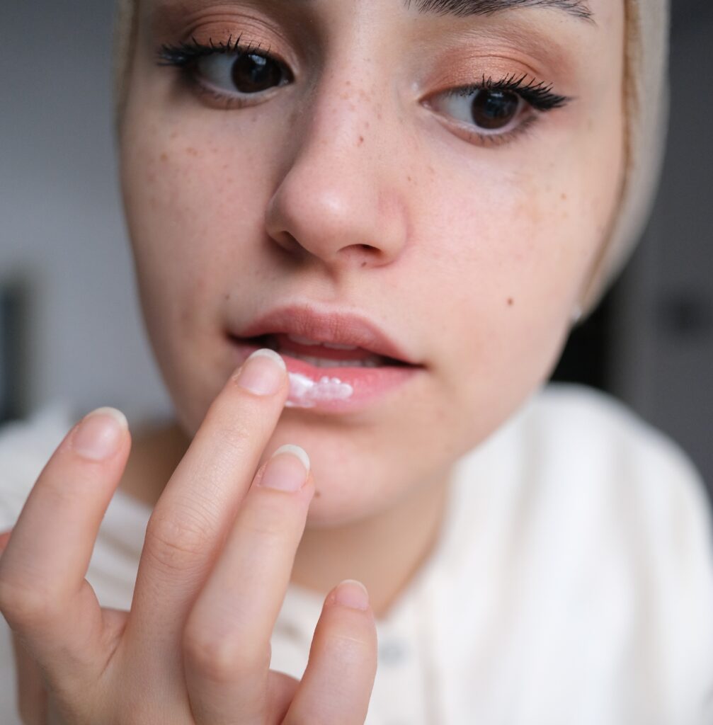 How Long After Dissolving Lip Filler Can You Refill?